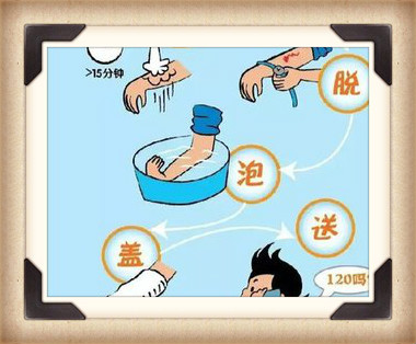 烫伤医院怎么治疗_烫伤医院_烫伤医院哪家好