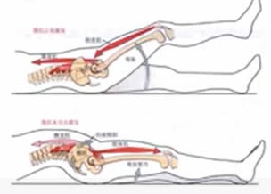 腰痛、膝痛原来是髋不好，1文了解详情！
