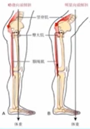 腰痛、膝痛原来是髋不好，1文了解详情！