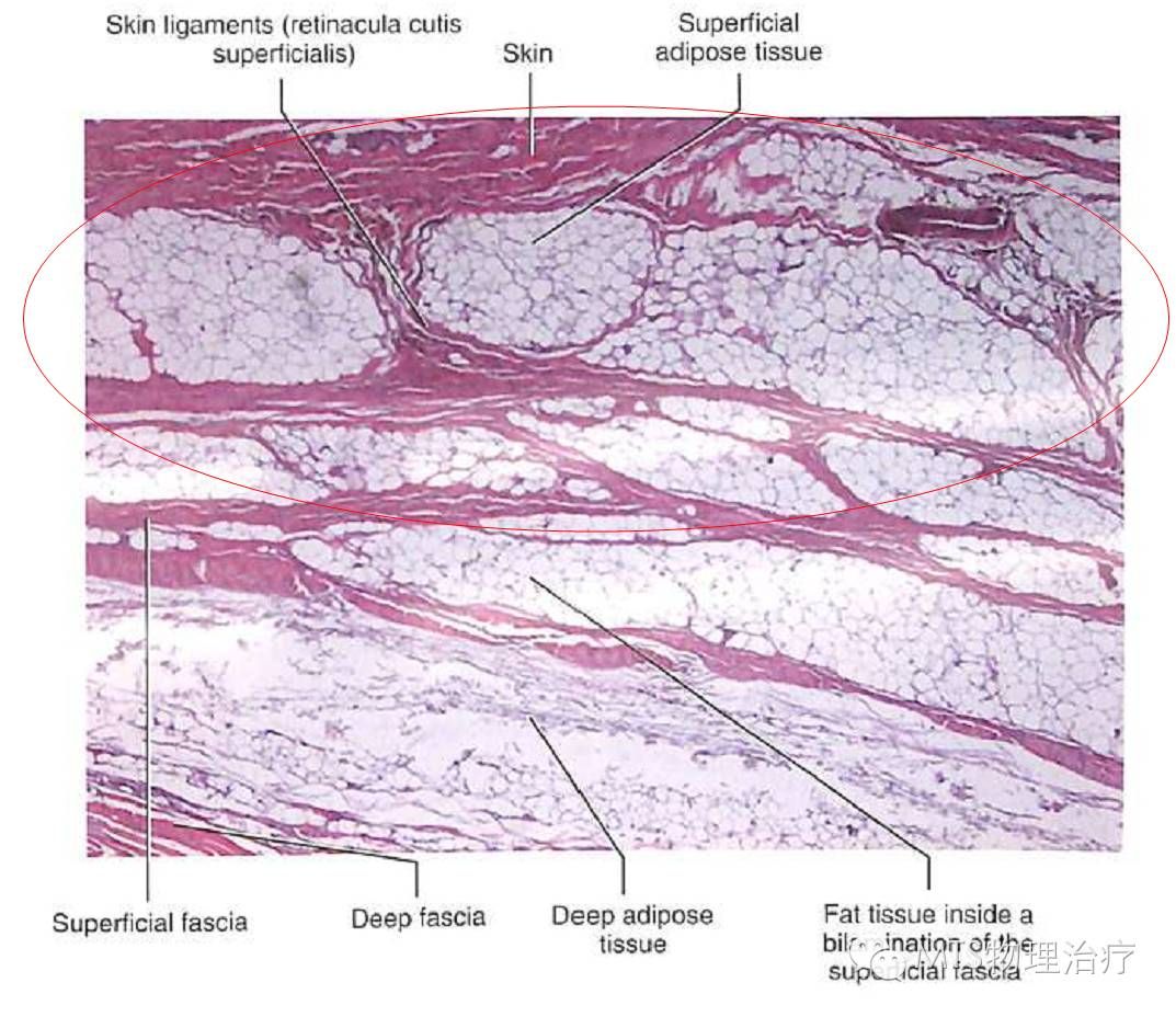 浅筋膜的解剖特点