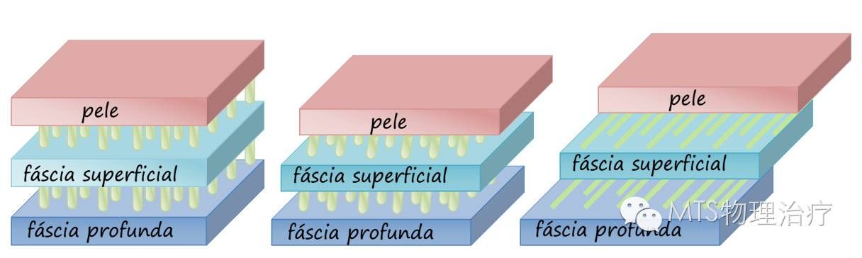 浅筋膜的解剖特点