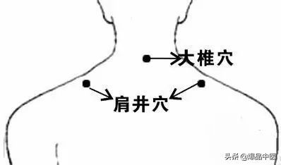 88个急救穴超清晰对照图，专穴专用，收藏