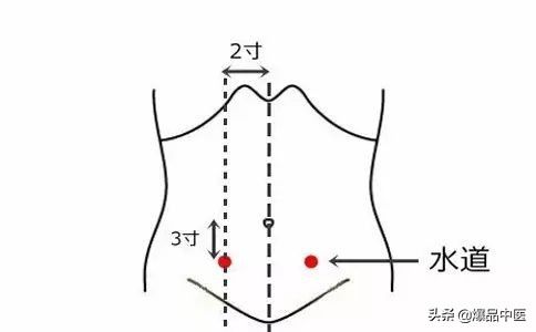 88个急救穴超清晰对照图，专穴专用，收藏