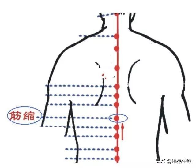 88个急救穴超清晰对照图，专穴专用，收藏