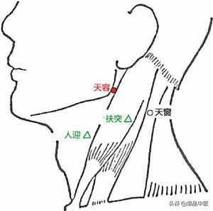 88个急救穴超清晰对照图，专穴专用，收藏