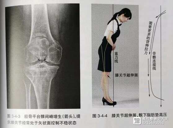 平衡疼痛---- 膝调节代偿与症状