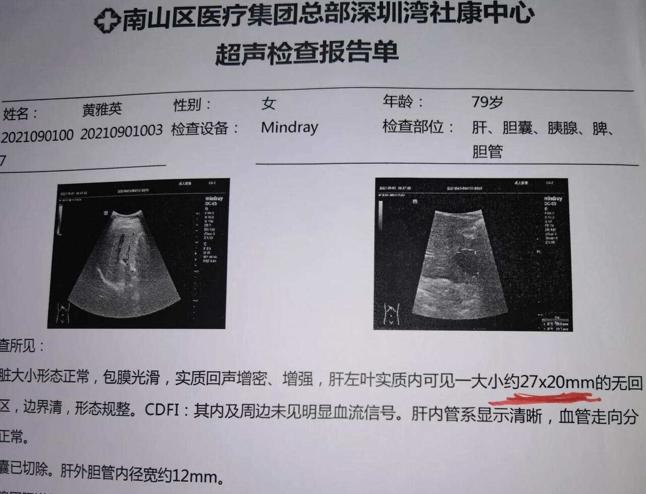 我意外发现毛茛草有清理血管里血栓及杀伤癌细胞的强大功能（四）...