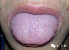 通肠药的区别应用