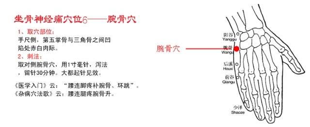 中医传统保健穴位养生——针灸艾灸治疗坐骨神经痛、腰椎间盘突出...