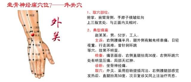 中医传统保健穴位养生——针灸艾灸治疗坐骨神经痛、腰椎间盘突出...