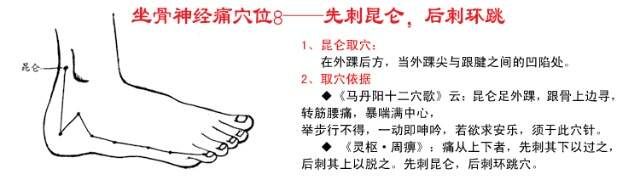 中医传统保健穴位养生——针灸艾灸治疗坐骨神经痛、腰椎间盘突出...