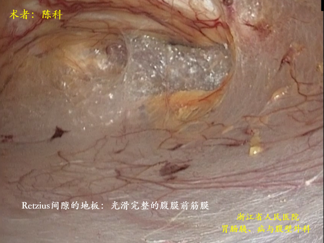 空间解剖学_图11 完成“空间转换”后的解剖展示_