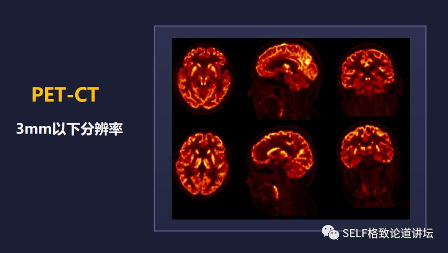 那么是什么造就了如此独特的我们