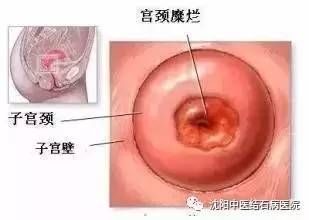 体检查出这9种病，千万别自己吓自己 !