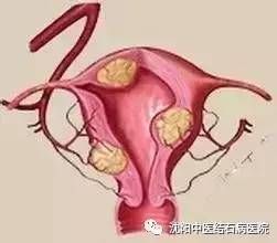 体检查出这9种病，千万别自己吓自己 !