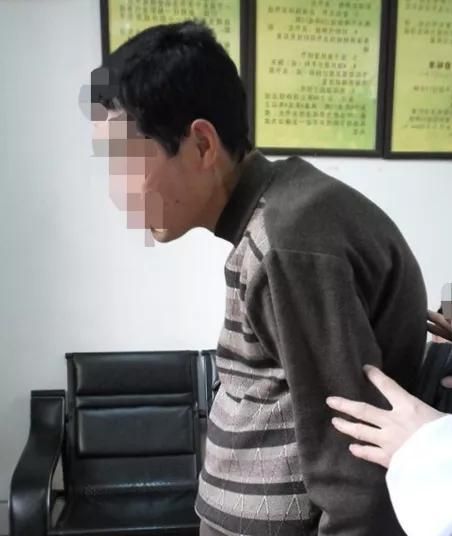 五体痹中的骨痹如何治疗呢