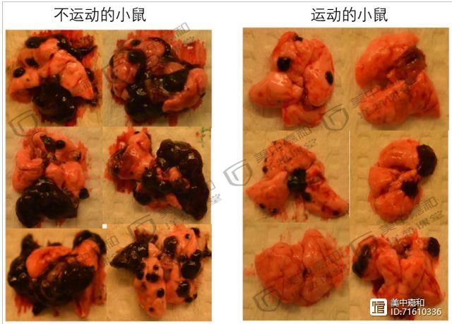 免疫衰老，老年人癌症高发的元凶！