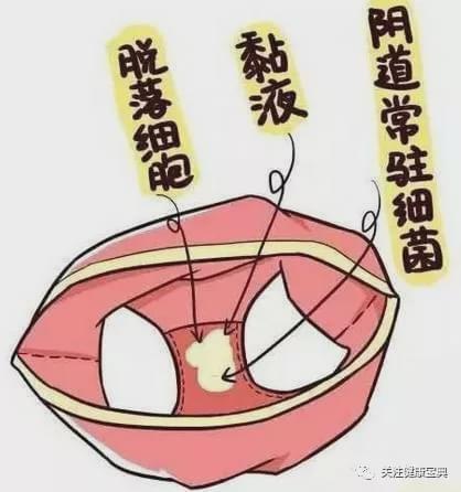 别再贩卖女性私处焦虑了！到底什么才算是正常？