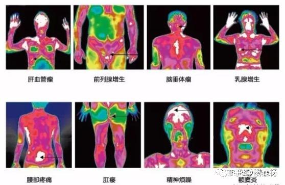 成像红外测温仪怎么用_红外成像_成像红外探测器有哪些