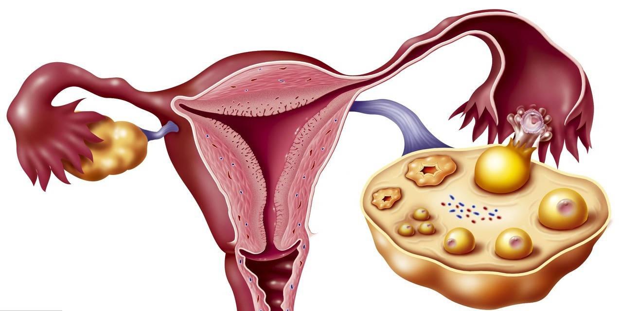 惊！女性卵巢囊肿的成因与治疗方法大揭秘！总结很全、很到位！