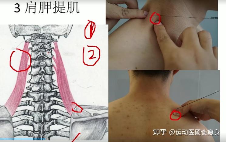 颈椎牵引器_牵引颈椎器对颈椎病可以治疗吗_牵引颈椎器的不良后果