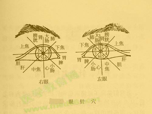 眼针_眼结石异物针疼吗_奶眼堵了用针怎么疏通