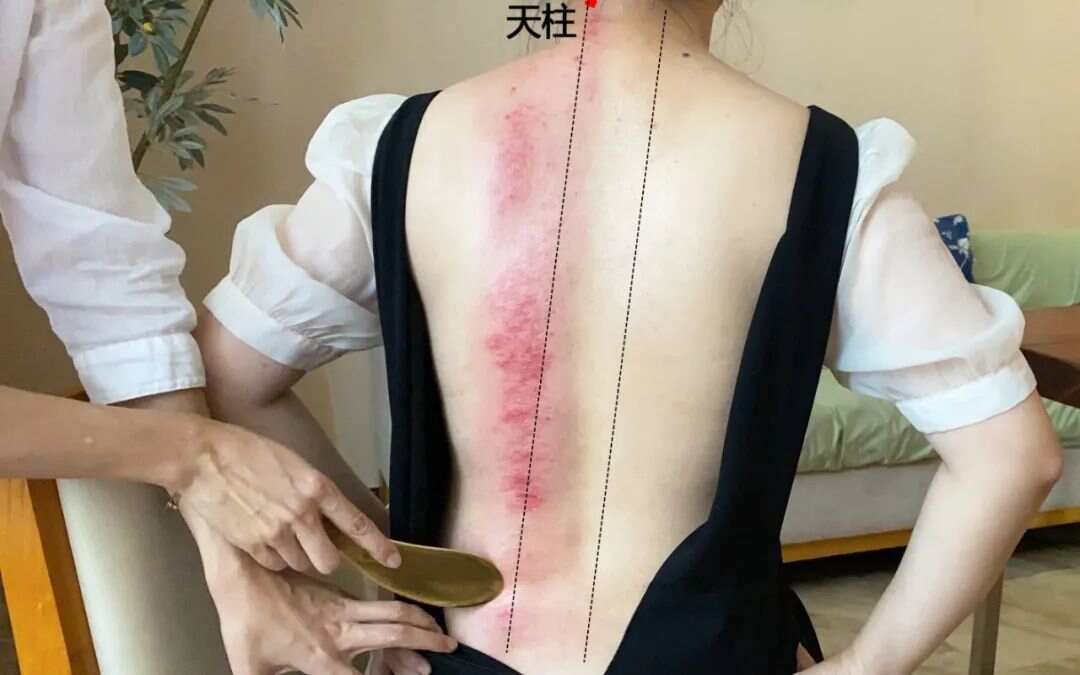 立秋后“清废水” | 刮痧这条经，通全身“下水道”