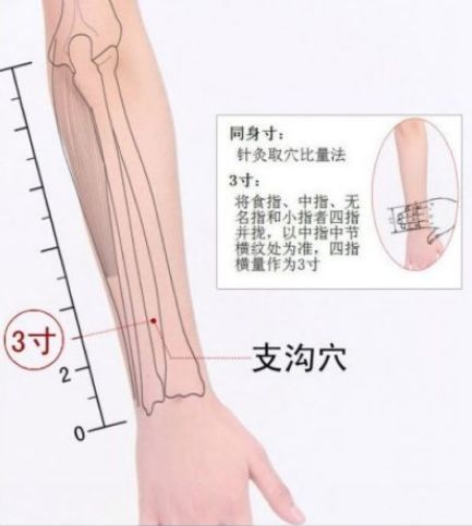每日一艾〡艾灸治疗带状疱疹后遗症的方法，值得一试！