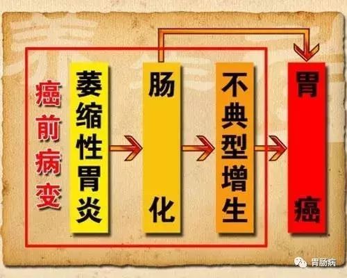 萎缩性胃炎的防治，一文搞定！