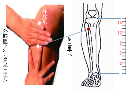 直肠癌治疗“特效穴”
