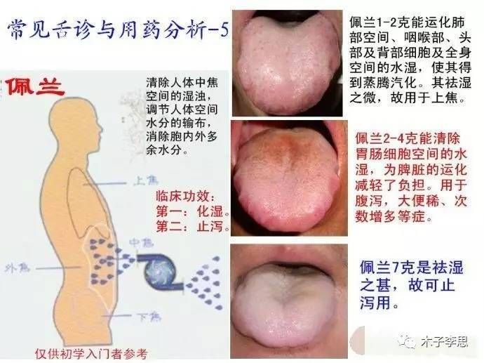 空间医学释疑