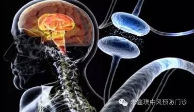 中风后抑郁，一个被忽略的问题！