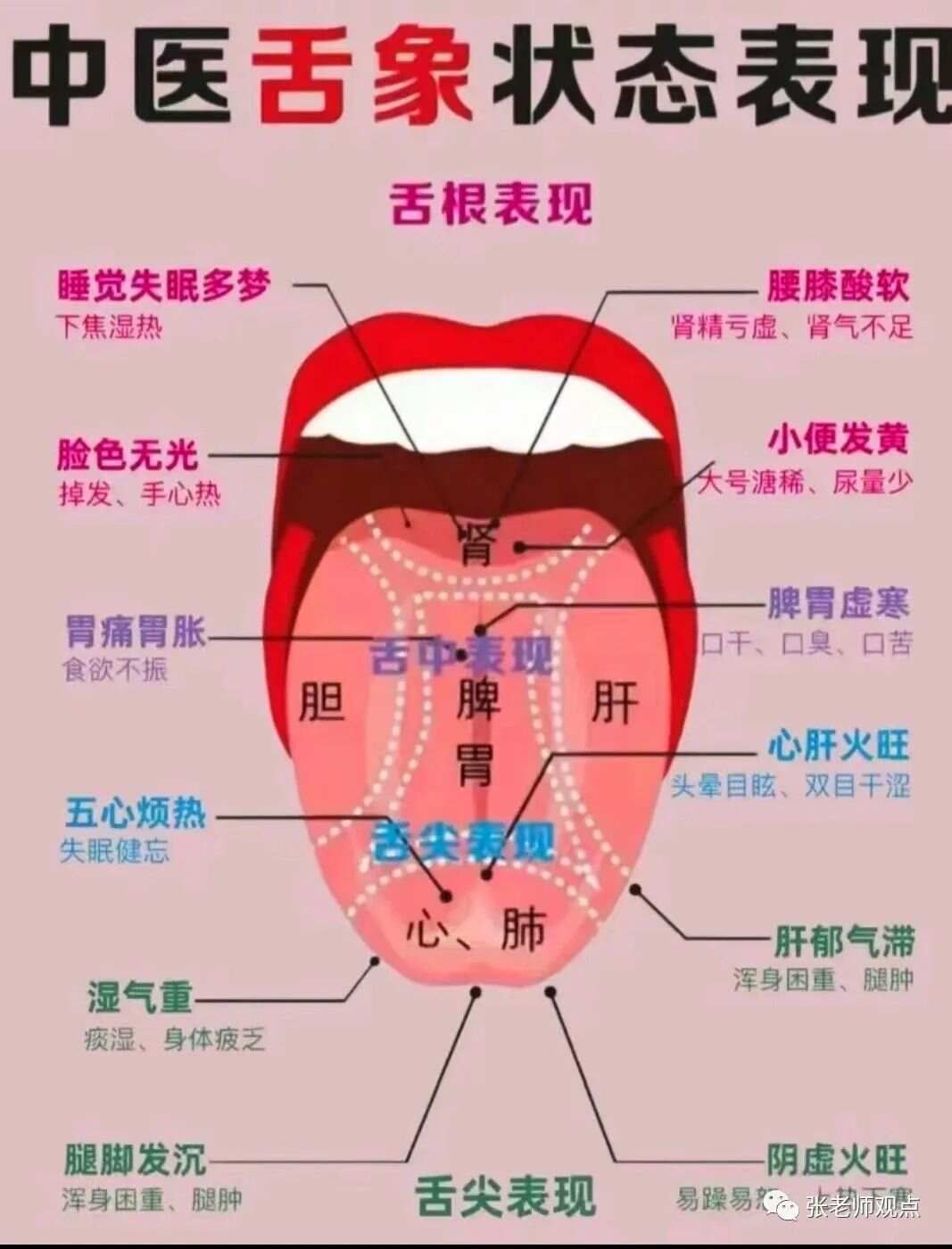 学习看舌相（一）