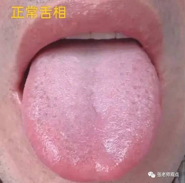 学习看舌相（一）