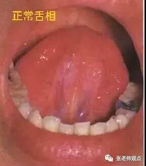 学习看舌相（一）