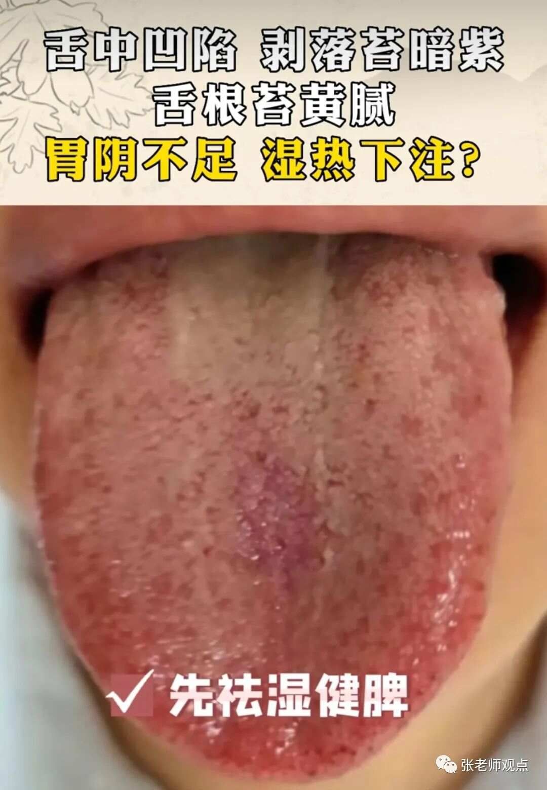 学习看舌相（一）