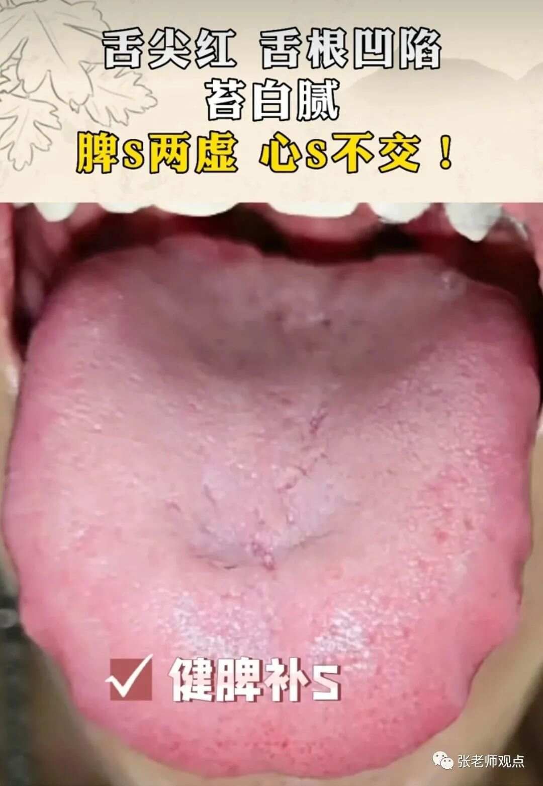 学习看舌相（一）