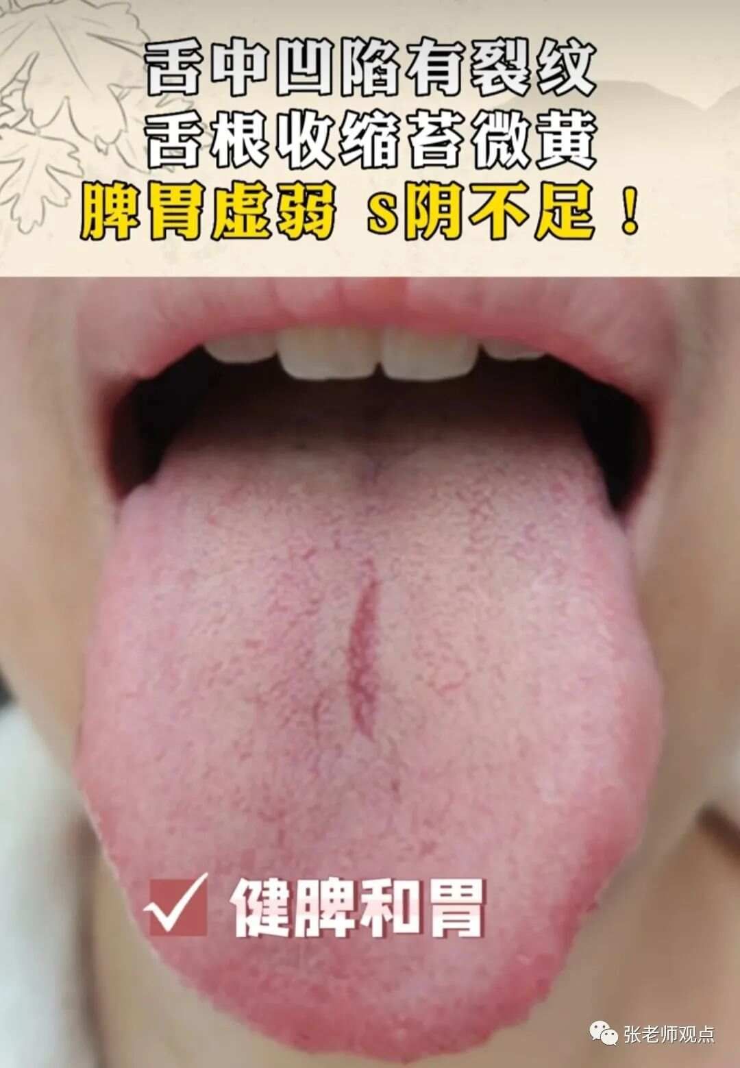 学习看舌相（一）