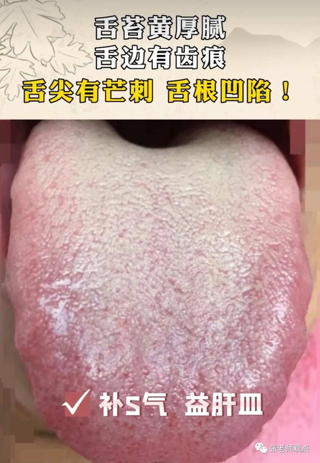 学习看舌相（一）