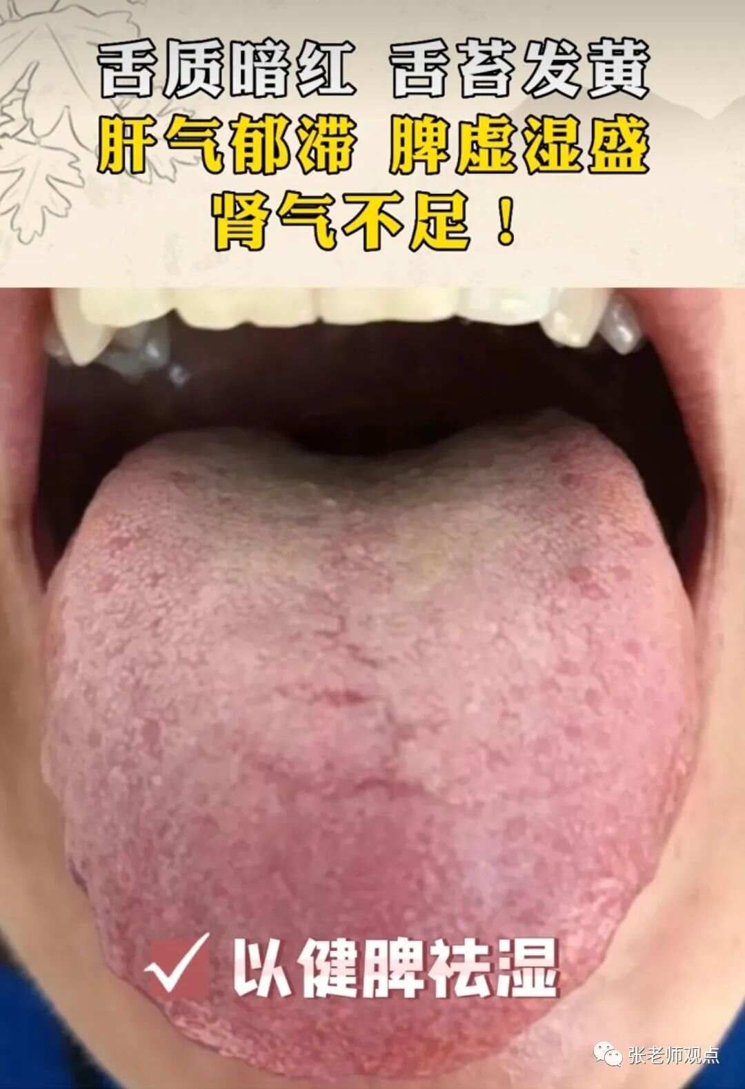 学习看舌相（一）