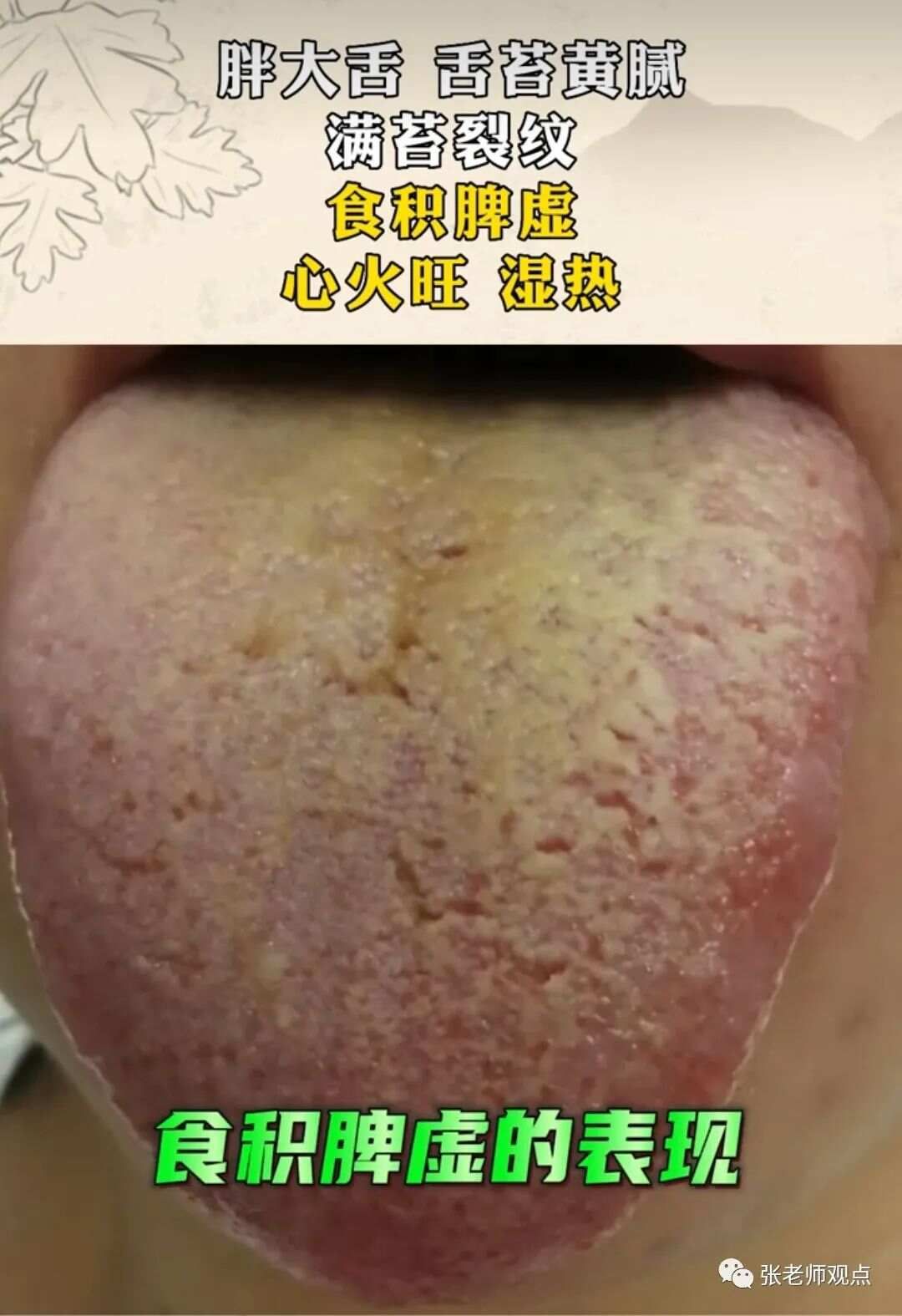 学习看舌相（一）