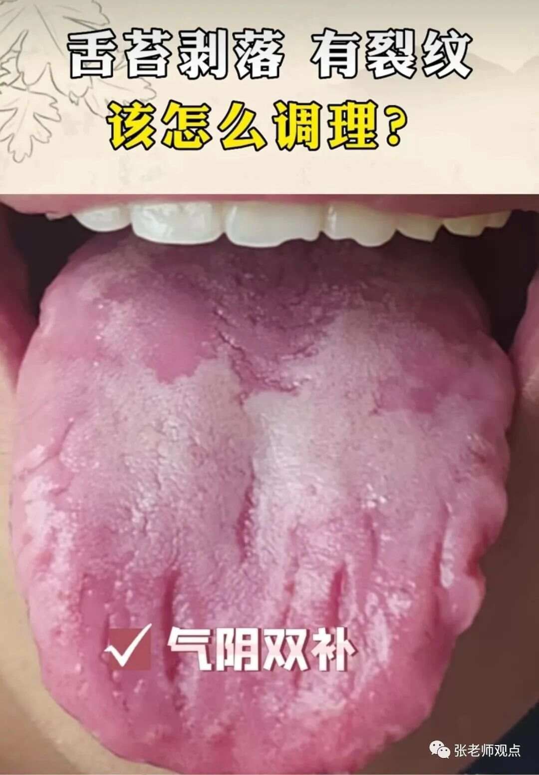 学习看舌相（一）