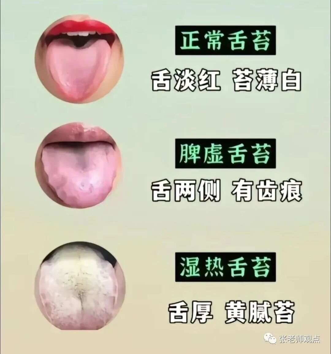学习看舌相（一）
