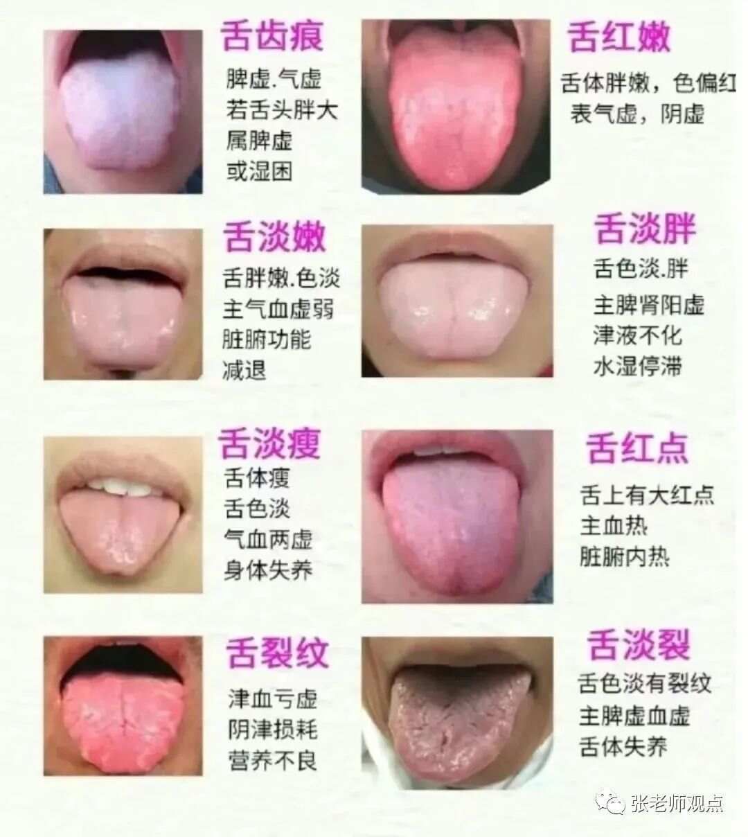 学习看舌相（一）