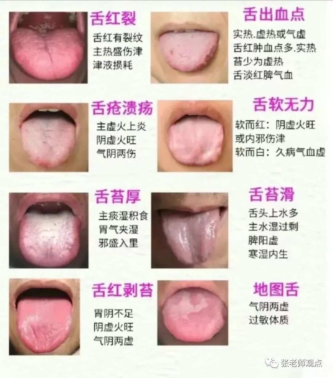 学习看舌相（一）