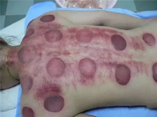 难怪你老那么快，经络都快堵死了！