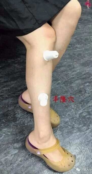 足阳明胃经——丰隆穴：祛湿化痰，第一要穴！