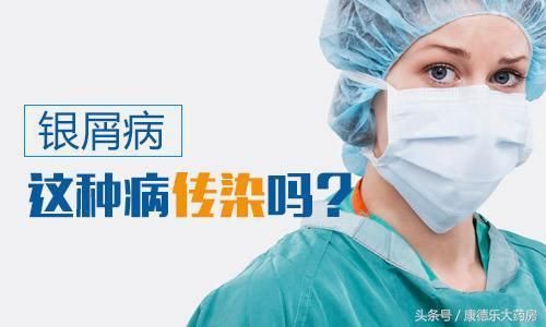 银屑病的6大外用西药
