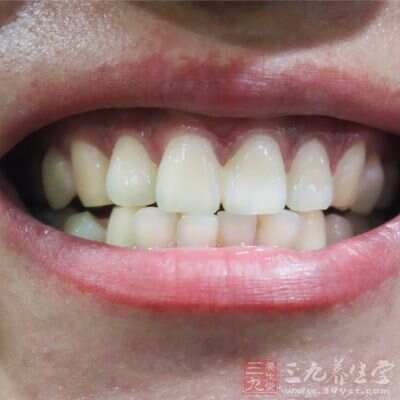 [身体]牙齿不老只因一年做了一次它