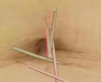 名中医工作室传承人学习分享（二十）—脐针治疗慢性鼻炎医案